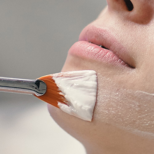 Chemical Peel
